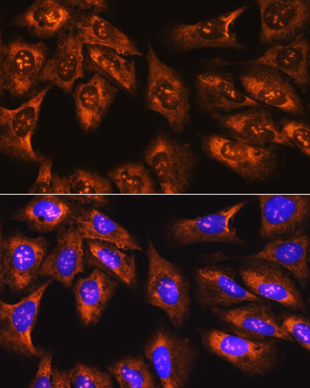 RPS3 Antibody in Immunocytochemistry (ICC/IF)