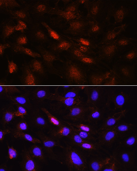 PLK1 Antibody in Immunocytochemistry (ICC/IF)