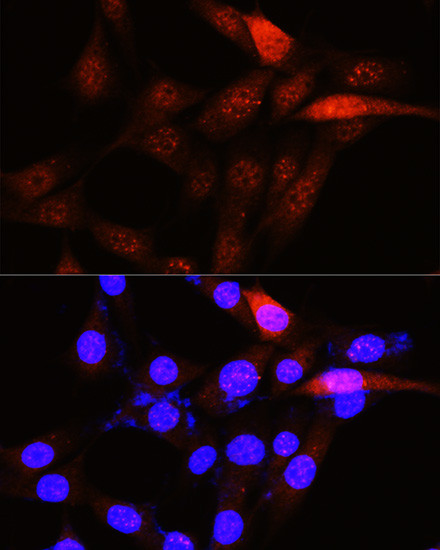 PLK1 Antibody in Immunocytochemistry (ICC/IF)