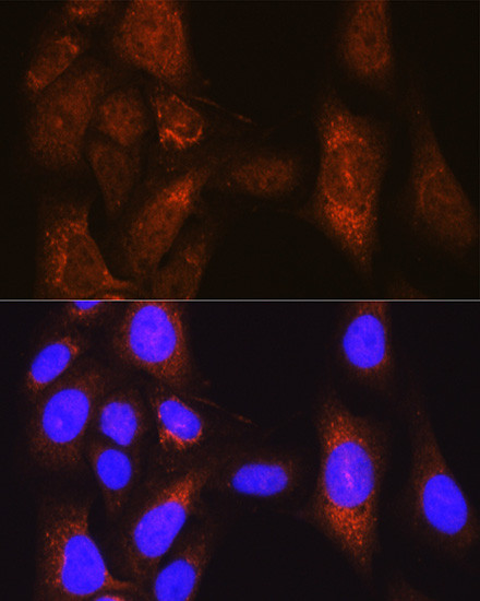 PLK1 Antibody in Immunocytochemistry (ICC/IF)