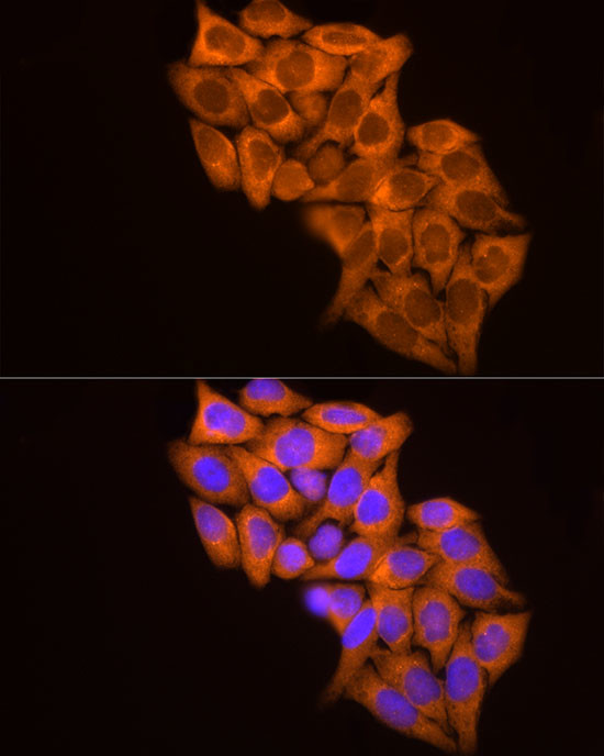 MMP14 Antibody in Immunocytochemistry (ICC/IF)