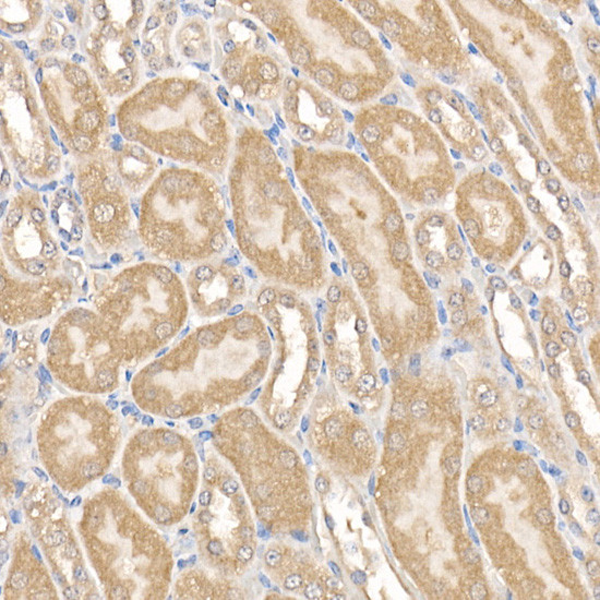 MMP14 Antibody in Immunohistochemistry (Paraffin) (IHC (P))