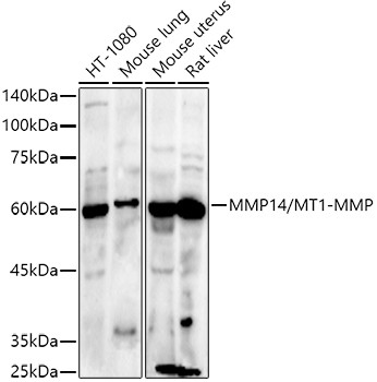 MMP14 Antibody in Western Blot (WB)