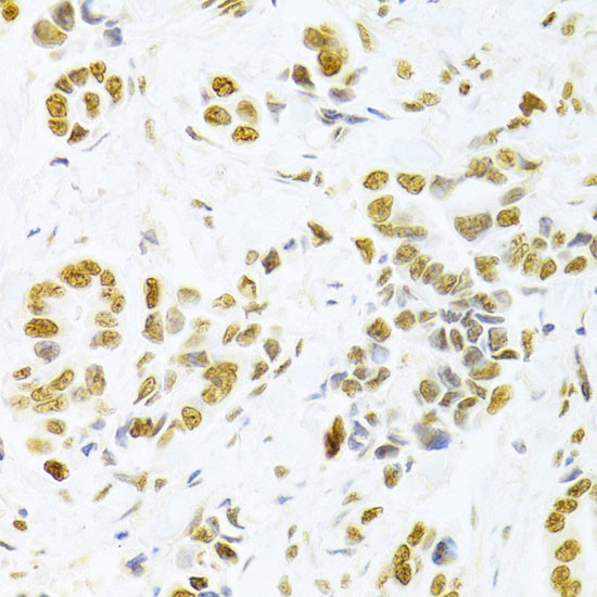 HMGB1 Antibody in Immunohistochemistry (Paraffin) (IHC (P))