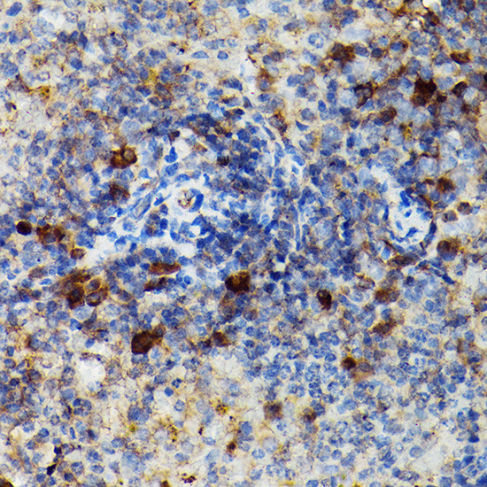 Granzyme B Antibody in Immunohistochemistry (Paraffin) (IHC (P))