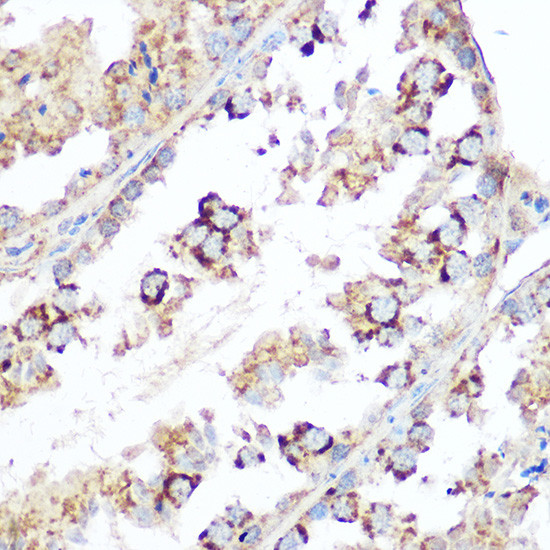 DIABLO Antibody in Immunohistochemistry (Paraffin) (IHC (P))