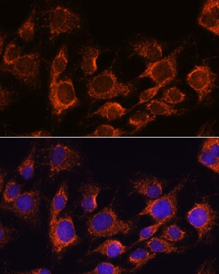 AIF Antibody in Immunocytochemistry (ICC/IF)