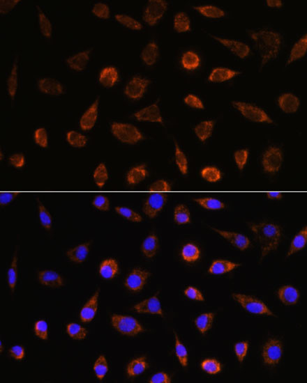 AIF Antibody in Immunocytochemistry (ICC/IF)