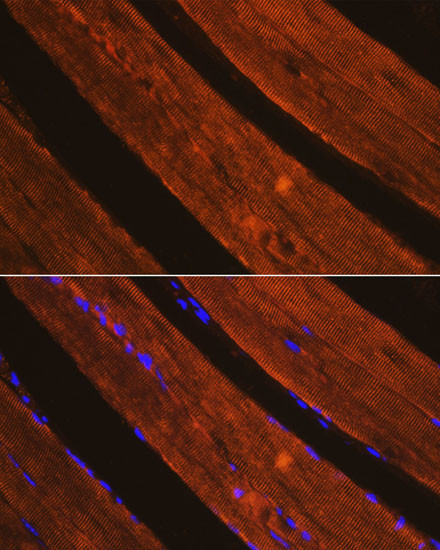 AIF Antibody in Immunohistochemistry (Paraffin) (IHC (P))