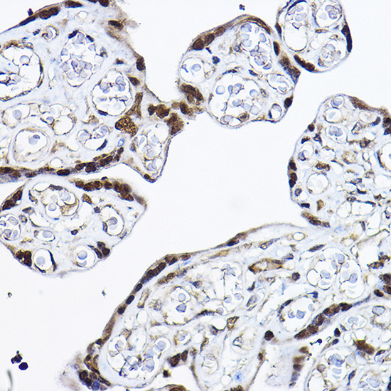 PDCD4 Antibody in Immunohistochemistry (Paraffin) (IHC (P))