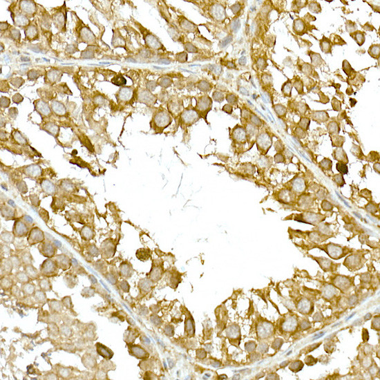 TBK1 Antibody in Immunohistochemistry (Paraffin) (IHC (P))