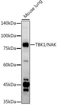 TBK1 Antibody in Western Blot (WB)