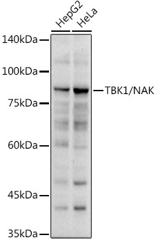 TBK1 Antibody in Western Blot (WB)