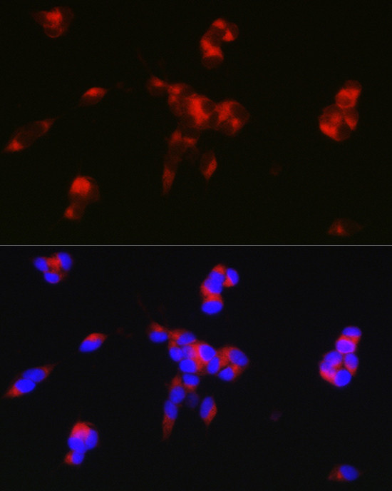 DARPP-32 Antibody in Immunocytochemistry (ICC/IF)