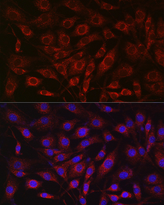 SDHA Antibody in Immunocytochemistry (ICC/IF)