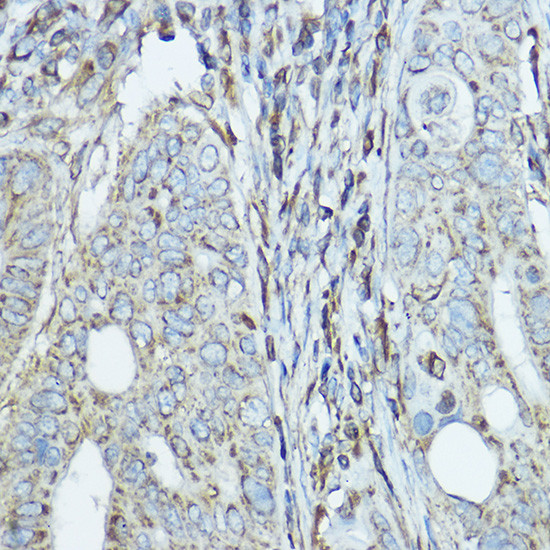 SDHA Antibody in Immunohistochemistry (Paraffin) (IHC (P))