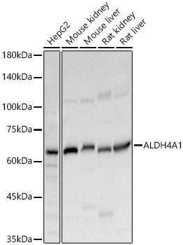 ALDH4A1 Antibody in Western Blot (WB)