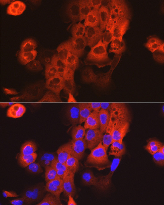 Cytokeratin 15 Antibody in Immunocytochemistry (ICC/IF)