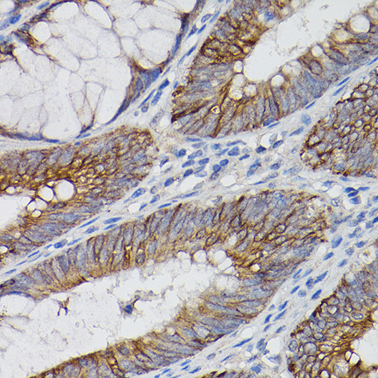 IL-18Ra Antibody in Immunohistochemistry (Paraffin) (IHC (P))