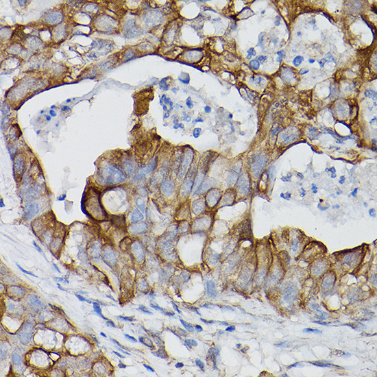 IL-18Ra Antibody in Immunohistochemistry (Paraffin) (IHC (P))