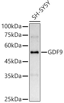 GDF9 Antibody in Western Blot (WB)