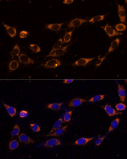 TRAP1 Antibody in Immunocytochemistry (ICC/IF)