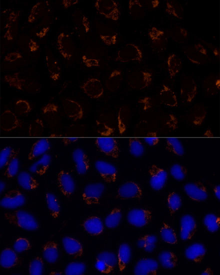 TRAP1 Antibody in Immunocytochemistry (ICC/IF)