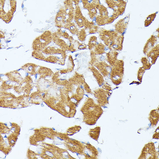 TRAP1 Antibody in Immunohistochemistry (Paraffin) (IHC (P))