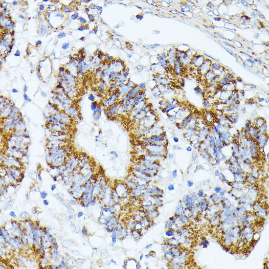 TRAP1 Antibody in Immunohistochemistry (Paraffin) (IHC (P))