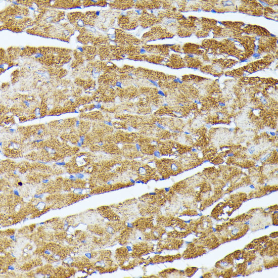 TRAP1 Antibody in Immunohistochemistry (Paraffin) (IHC (P))