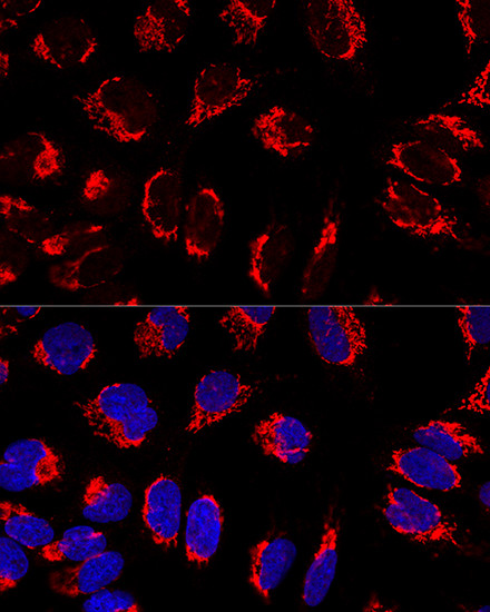 Mitofilin Antibody in Immunocytochemistry (ICC/IF)