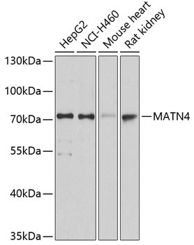 MATN4 Antibody in Western Blot (WB)