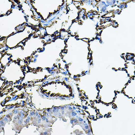 ACE Antibody in Immunohistochemistry (Paraffin) (IHC (P))