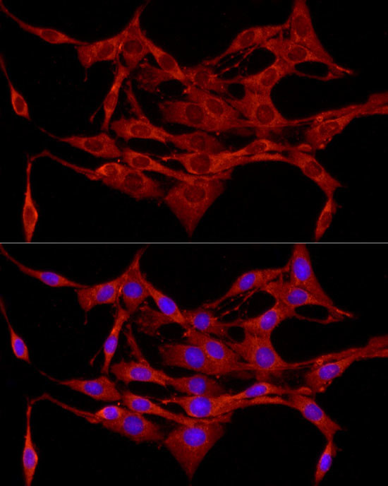 Protein APC Antibody in Immunocytochemistry (ICC/IF)