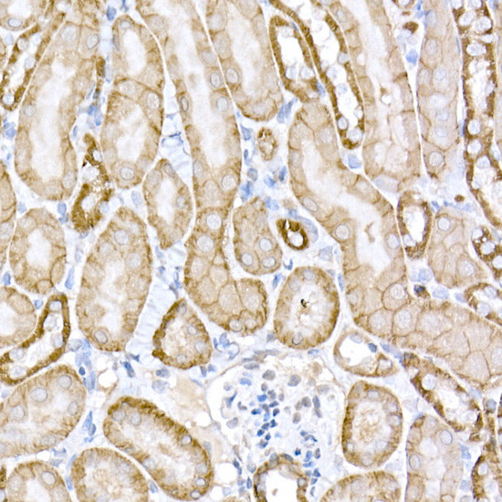 Protein APC Antibody in Immunohistochemistry (Paraffin) (IHC (P))