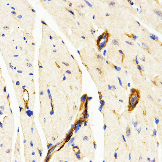 LAMP3 Antibody in Immunohistochemistry (Paraffin) (IHC (P))