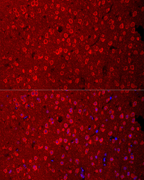 EAAC1 Antibody in Immunohistochemistry (Paraffin) (IHC (P))