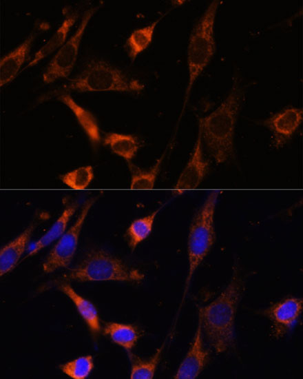 CKMT1B Antibody in Immunocytochemistry (ICC/IF)