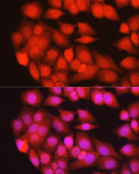 MURF1 Antibody in Immunocytochemistry (ICC/IF)