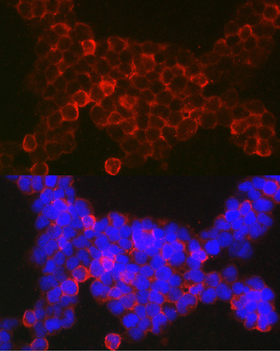 NFATC2 Antibody in Immunocytochemistry (ICC/IF)