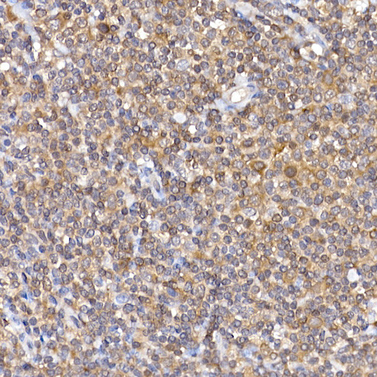 NFATC2 Antibody in Immunohistochemistry (Paraffin) (IHC (P))