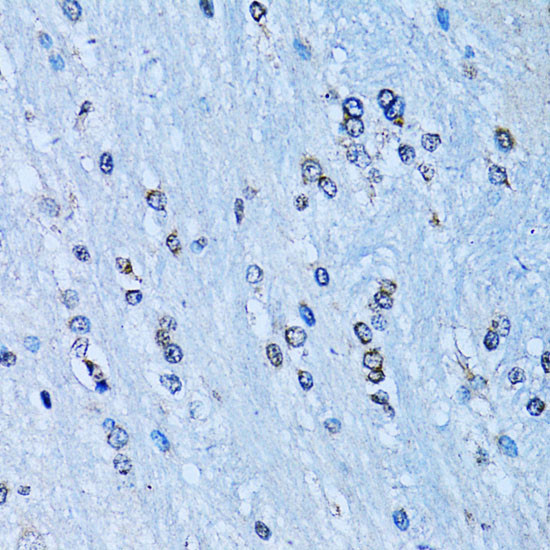 NFkB p52 Antibody in Immunohistochemistry (Paraffin) (IHC (P))