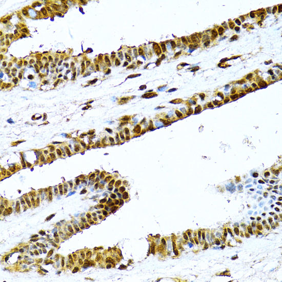 NFkB p52 Antibody in Immunohistochemistry (Paraffin) (IHC (P))