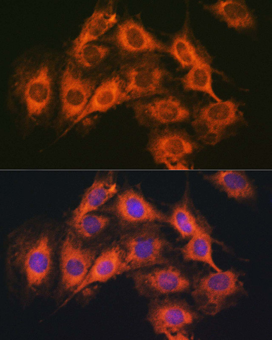 PACAP Receptor Antibody in Immunocytochemistry (ICC/IF)