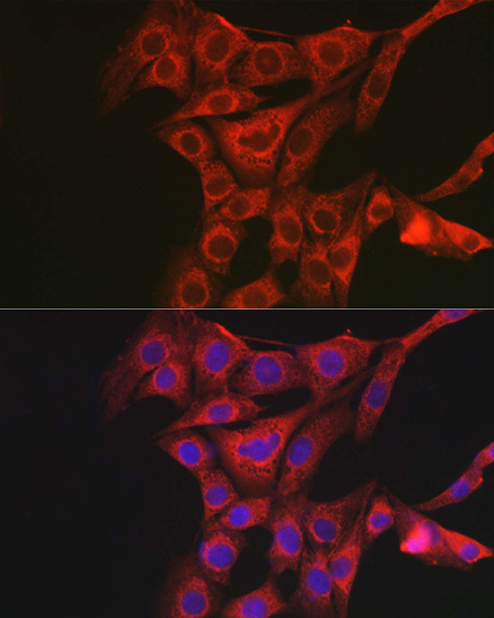 PACAP Receptor Antibody in Immunocytochemistry (ICC/IF)