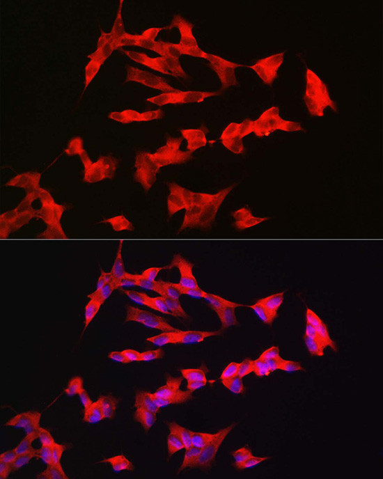 PACAP Receptor Antibody in Immunocytochemistry (ICC/IF)