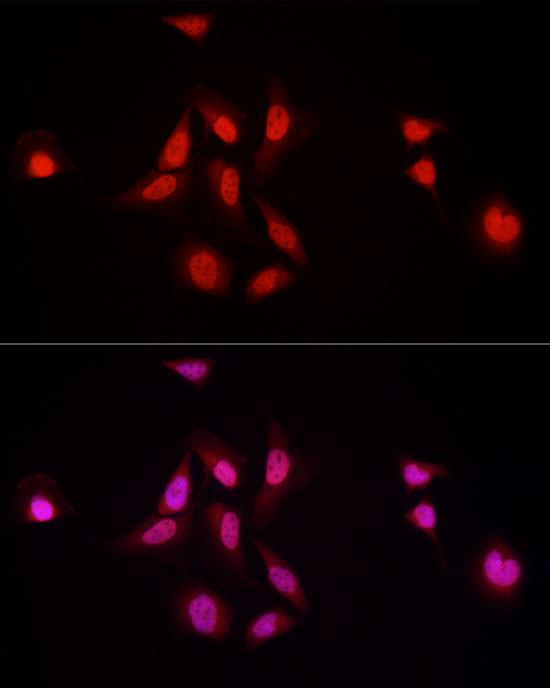 NFIA Antibody in Immunocytochemistry (ICC/IF)