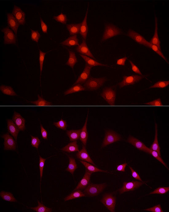 NFIA Antibody in Immunocytochemistry (ICC/IF)