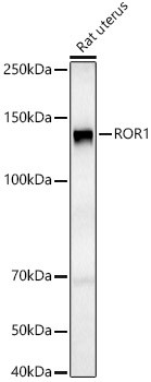 ROR1 Antibody in Western Blot (WB)