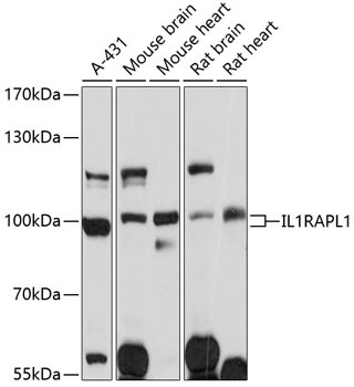 IL1RAPL1 Antibody in Western Blot (WB)